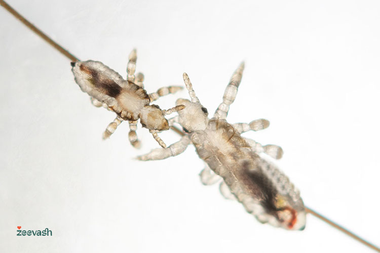 شپش، حشره‌ای کوچک و بدون بال است که در رده انگل‌ها قرار می‌گیرد